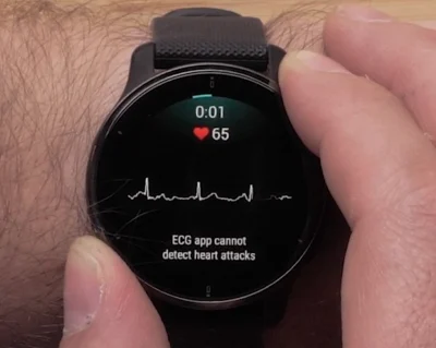 GARMIN ECG ATNAUJINIMAS FENIX 7 SERIJAI