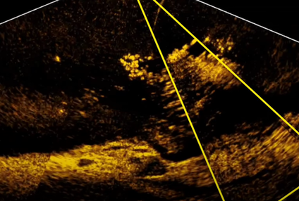 LOWRANCE ACTIVE TARGET SONARAI