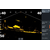 LOWRANCE ACTIVETARGET 2 LIVE SONARO KOMPLEKTAS, 000-15959-001